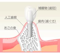 sec1_image